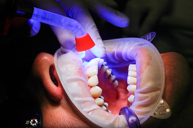 Bezbolesne leczenie zębów – stomatologia Warszawa Radość