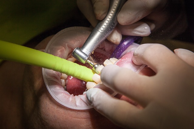 Stomatolog na Ochocie –  cena implantów stomatologicznych