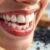 Wybielanie zębów węglem aktywnym – skuteczność i bezpieczeństwo tej metody